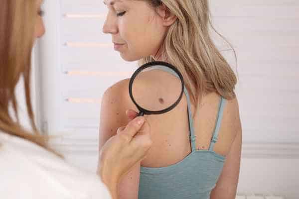 What Are Traditional Skin Lesion Removal Methods Lowestoft?