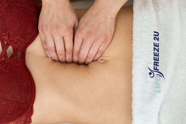 diastasis recti treatment Lowestoft