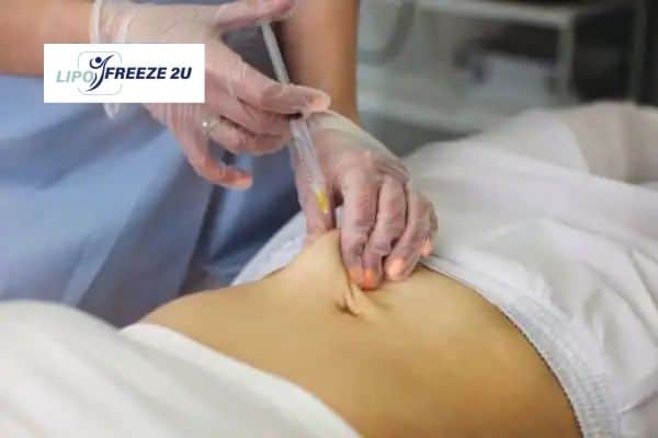 Fat Dissolving Injections Lowestoft & Weight loss medication