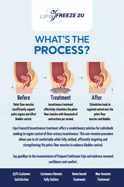Diagram of how incontinence treatment Lowestoft works.