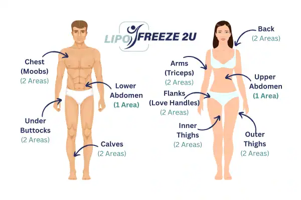 Areas you can have fat freezing treatment Lowestoft