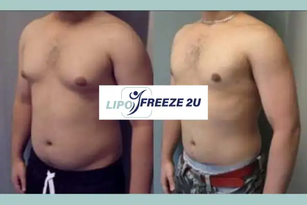 How Long Does It Take to See Results Lowestoft?