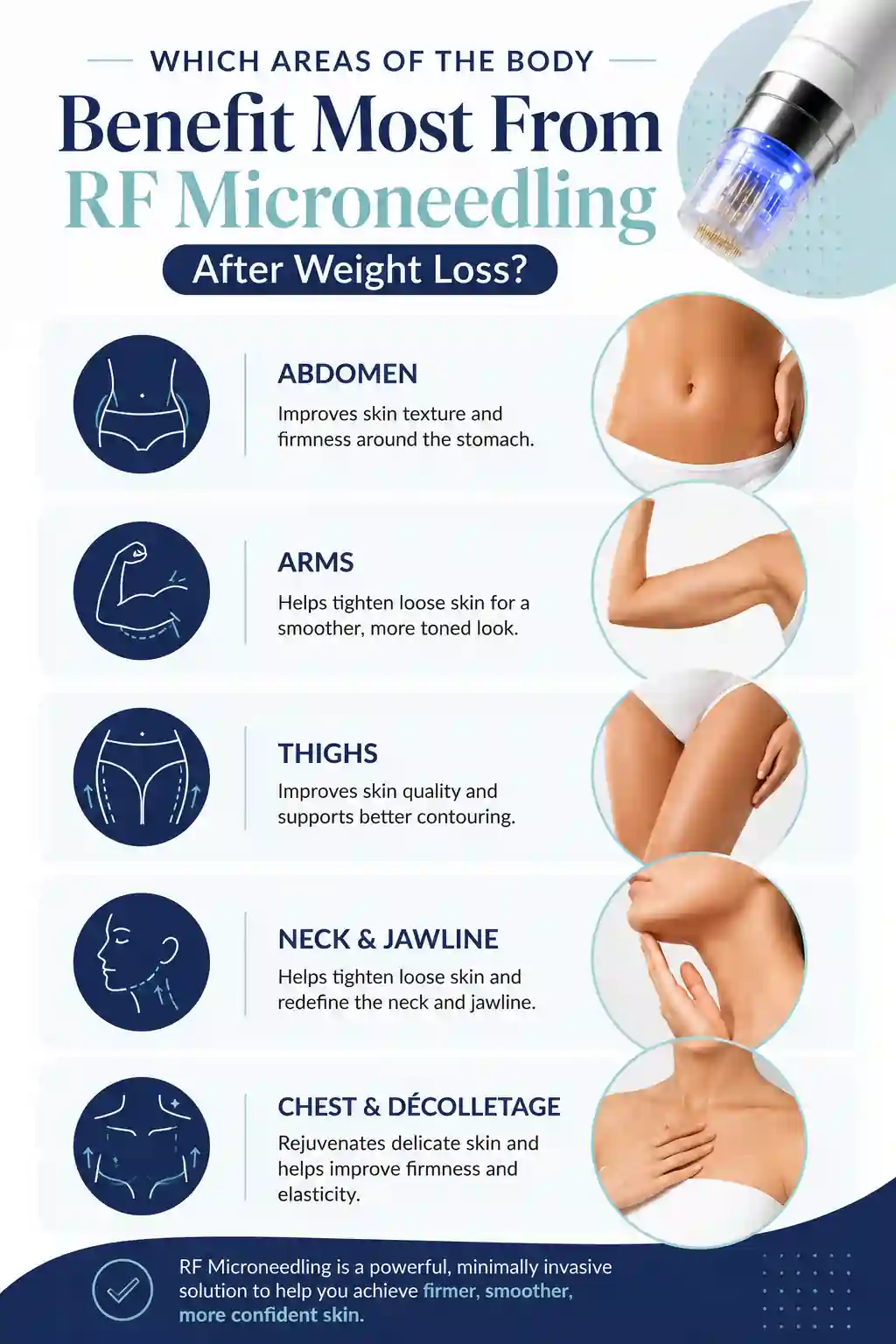 Which Areas of the Body Benefit Most From RF Microneedling After Weight Loss Lowestoft